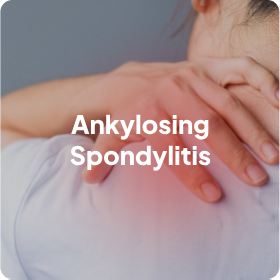 Ankylosing Spondylitis