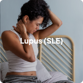 Lupus (SLE)