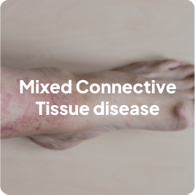 Mixed Connective Tissue disease