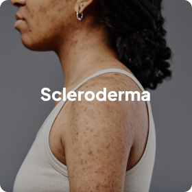 Scleroderma