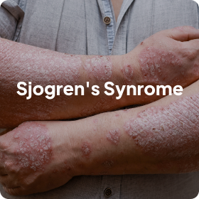 Sjogren's Synrome